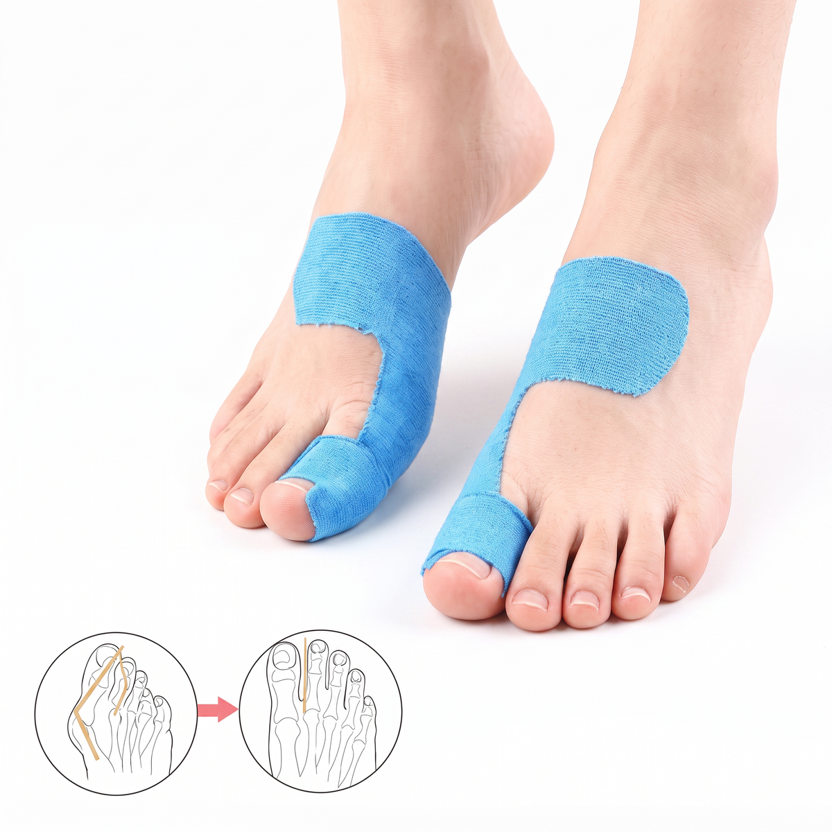 Bunion Tape – Adjustable – Skin Friendly – For Toe Support